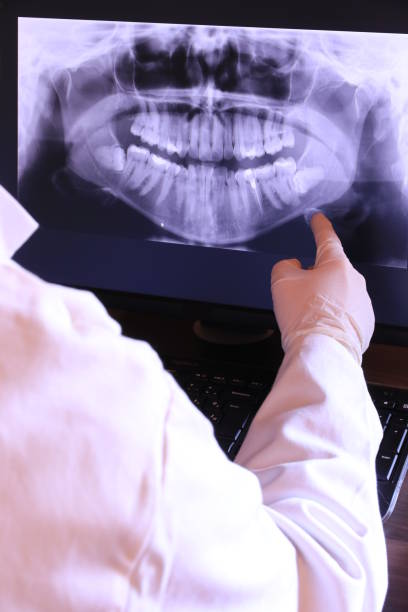 Best Broken or Cracked Tooth Emergency Dentist in West Park, FL